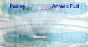 Leaking Amniotic Fluid Self Test