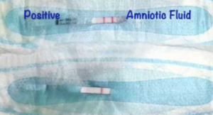 amniotic fluid leak test at home