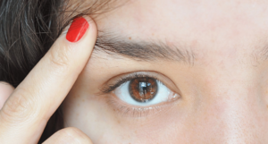 Pimples on Eyebrows Causes