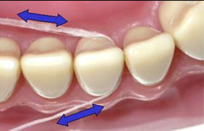 Dental Floss helps to reduce itchy gums